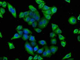 Immunofluorescence staining of Hela cells with CSB-PA22749A0Rb at 1:100, counter-stained with DAPI. The cells were fixed in 4% formaldehyde, permeabilized using 0.2% Triton X-100 and blocked in 10% normal Goat Serum. The cells were then incubated with the antibody overnight at 4°C. The secondary antibody was Alexa Fluor 488-congugated AffiniPure Goat Anti-Rabbit IgG(H+L).