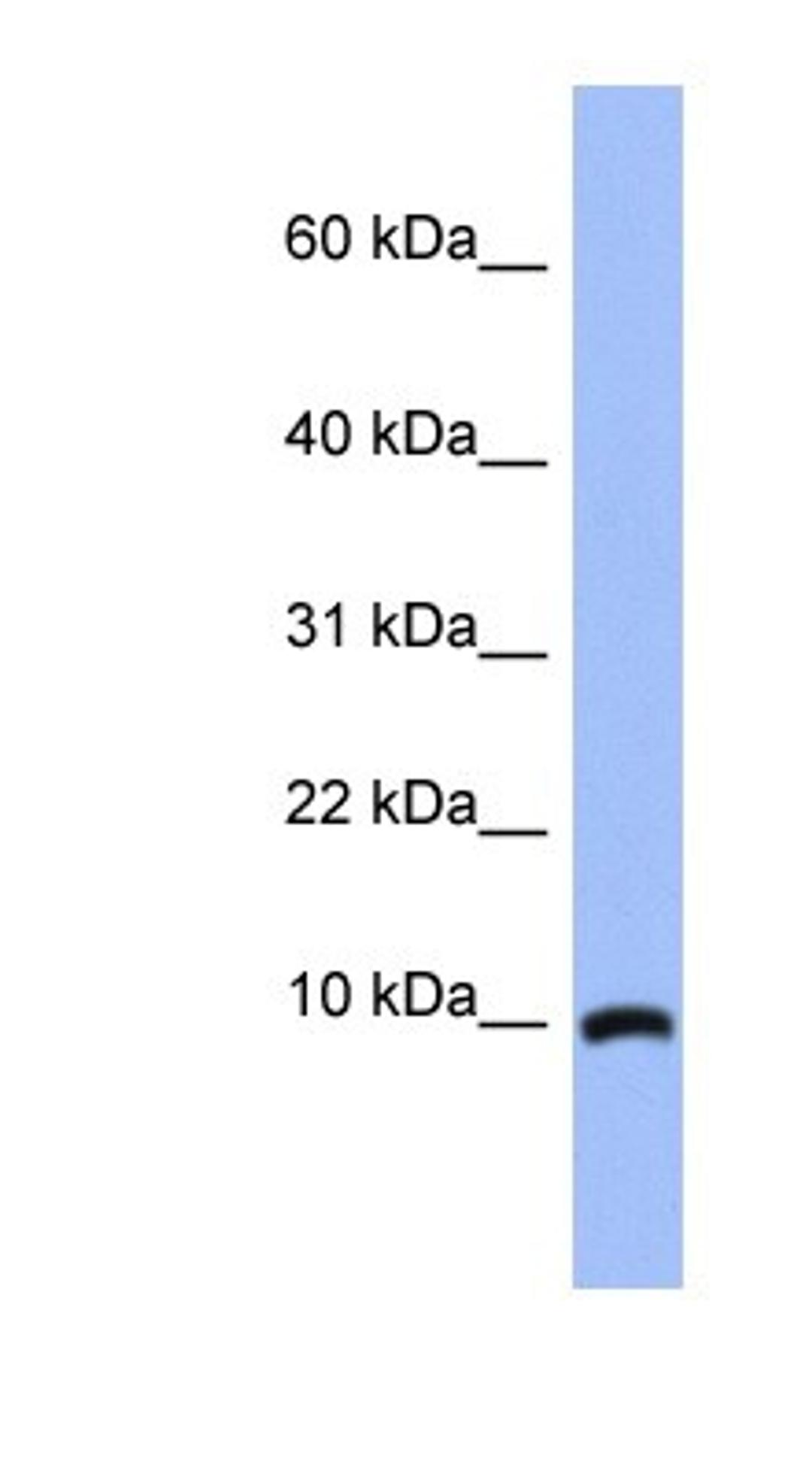 Western Blot: ACBD7 Antibody [NBP1-56527] - Human Brain lysate, concentration 0.2-1 ug/ml.