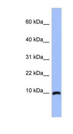 Western Blot: ACBD7 Antibody [NBP1-56527] - Human Brain lysate, concentration 0.2-1 ug/ml.