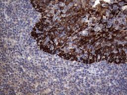 Immunohistochemistry: CCL19/MIP-3 beta Antibody (2A12) [NBP2-46082] - Analysis of Human tonsil tissue. (Heat-induced epitope retrieval by 1 mM EDTA in 10mM Tris, pH8.5, 120C for 3min)