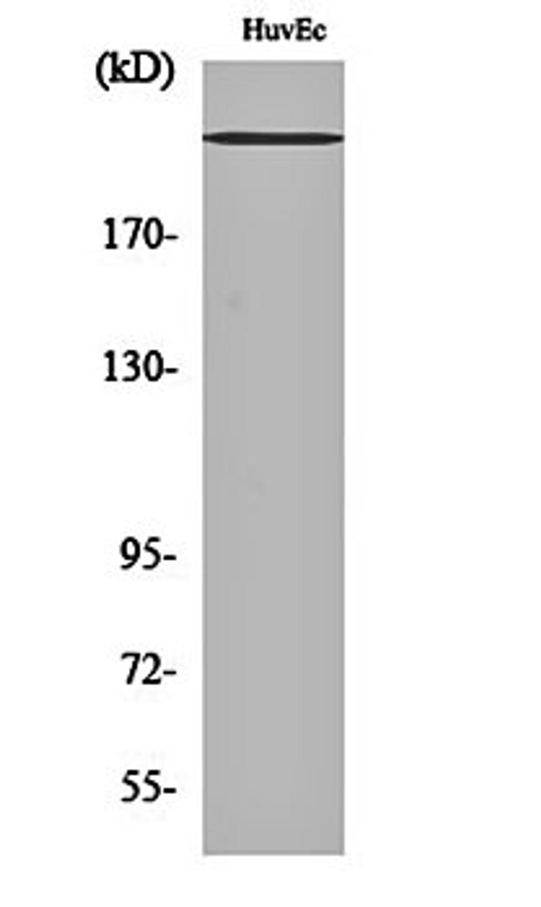 Western blot analysis of HuvEc cell lysates using Na+ CP-pan antibody