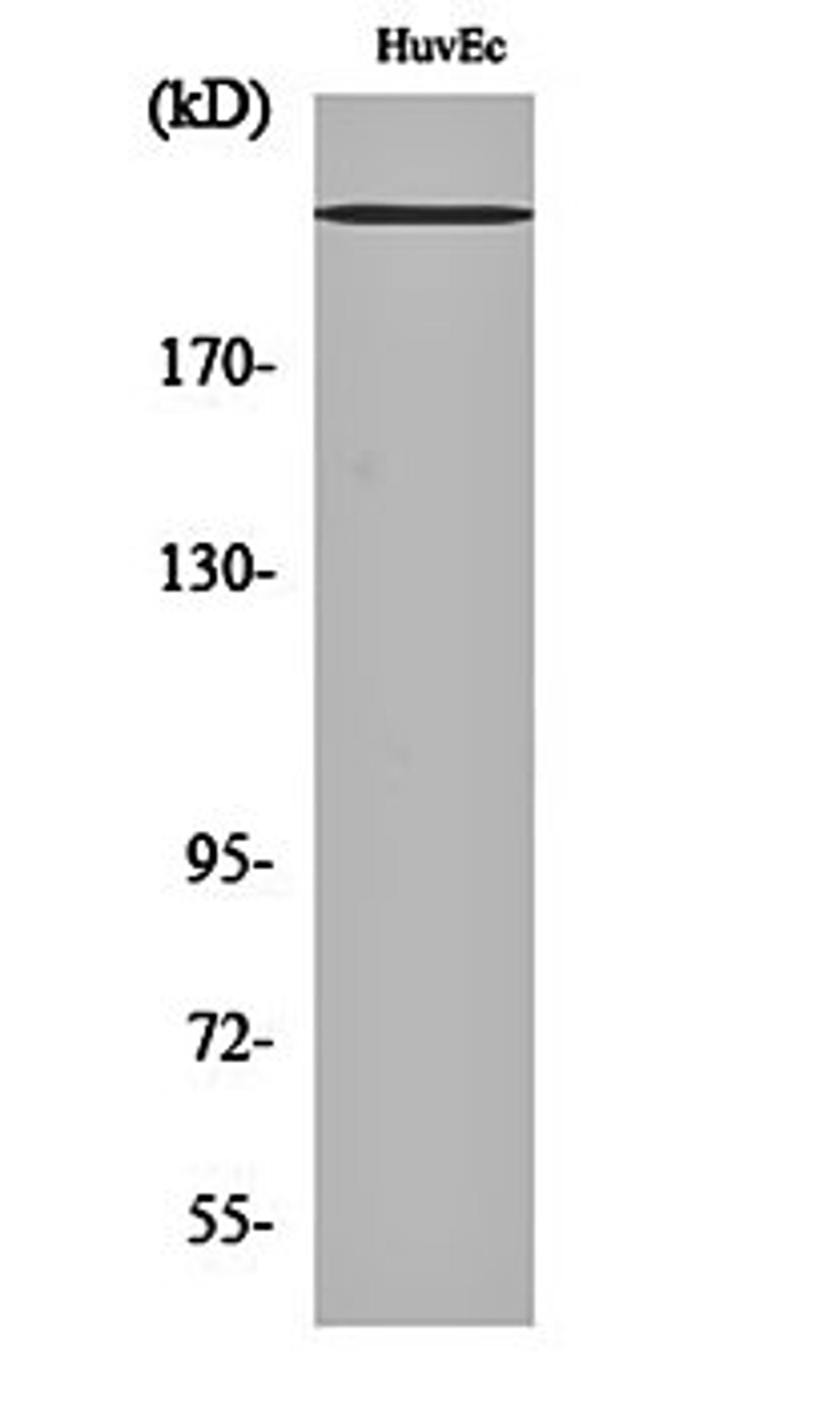 Western blot analysis of HuvEc cell lysates using Na+ CP-pan antibody