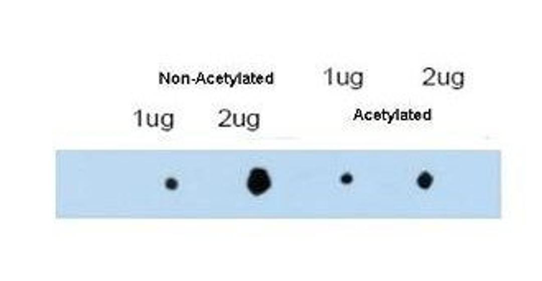 Western blot analysis of dot blot with acetylated and non-acetylated forms of the immunizing peptide using ATDC antibody