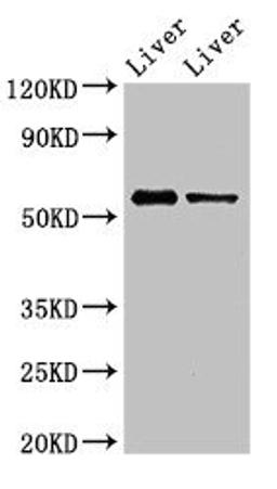 Western Blot. Positive WB detected in: Mouse liver tissue, Rat liver tissue. All lanes: ETV1 antibody at 3ug/ml. Secondary. Goat polyclonal to rabbit IgG at 1/50000 dilution. Predicted band size: 56, 54, 53, 44, 49, 51 kDa. Observed band size: 56 kDa. 