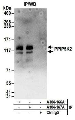 Detection of human PPIP5K2 by western blot of immunoprecipitates.