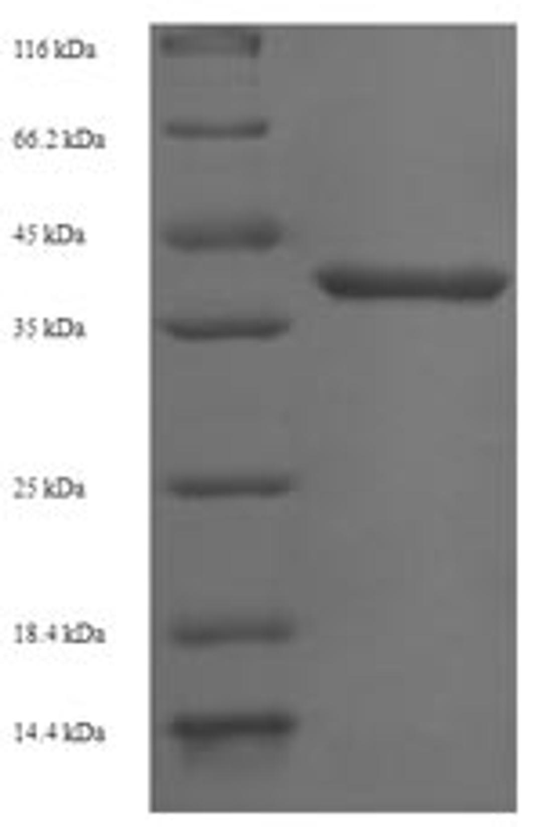 (Tris-Glycine gel) Discontinuous SDS-PAGE (reduced) with 5% enrichment gel and 15% separation gel.