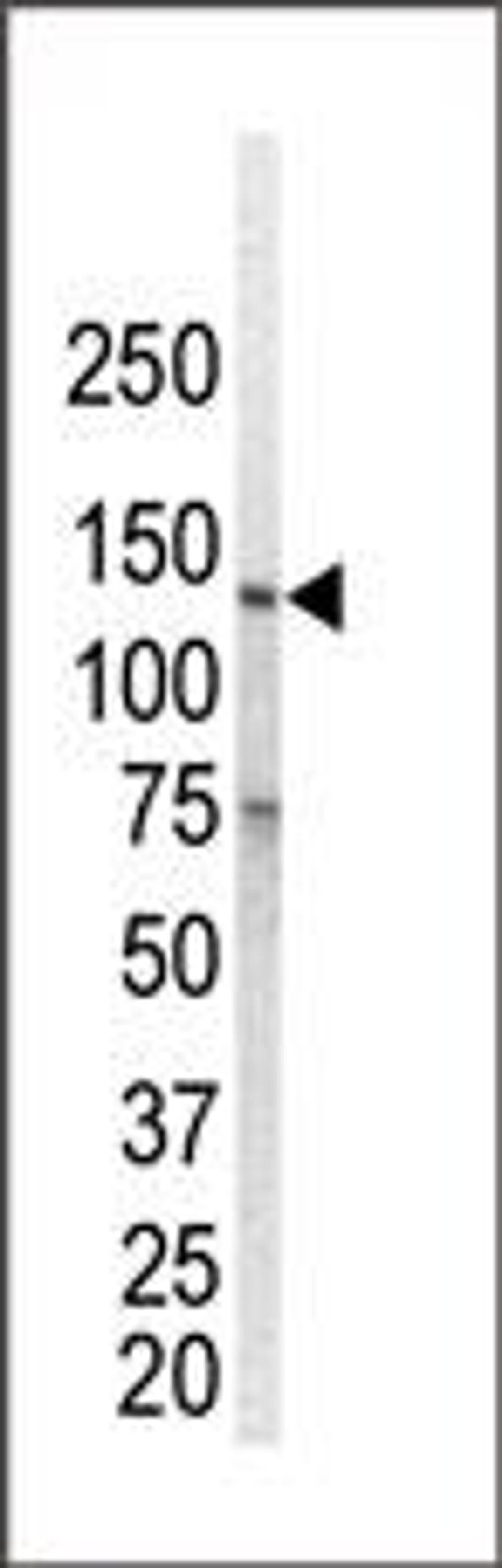 Western blot analysis of anti-ErbB1 Pab in ZR-75-1 cell lysate