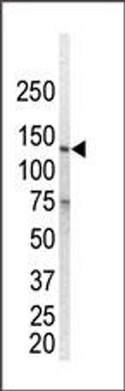 Western blot analysis of anti-ErbB1 Pab in ZR-75-1 cell lysate