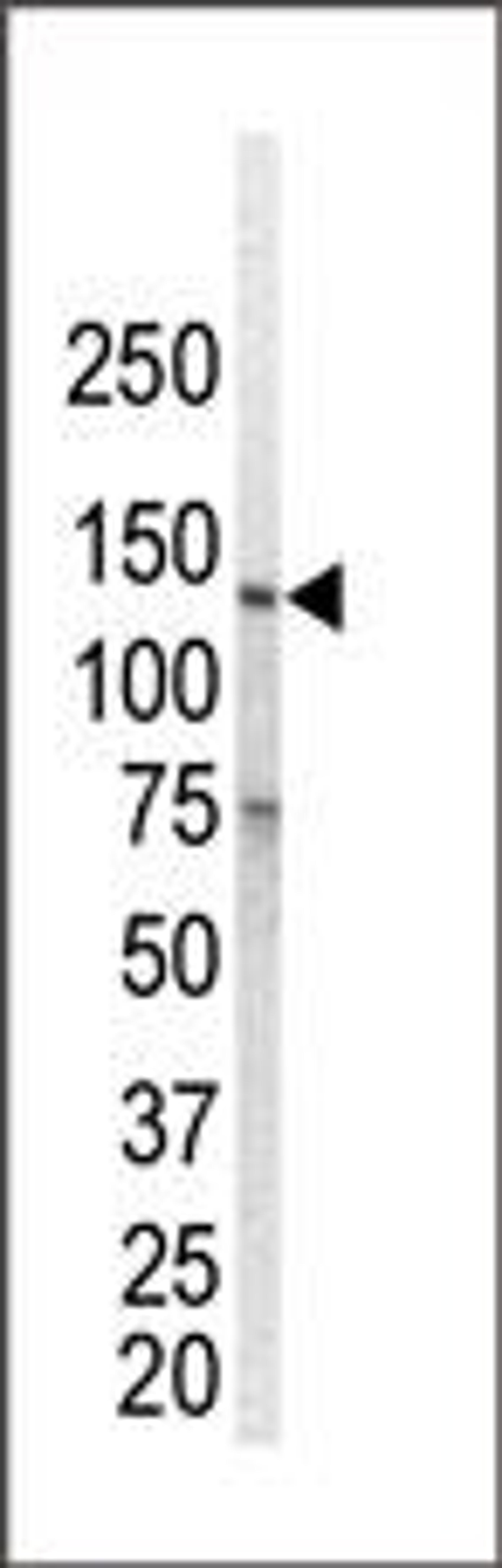 Western blot analysis of anti-ErbB1 Pab in ZR-75-1 cell lysate