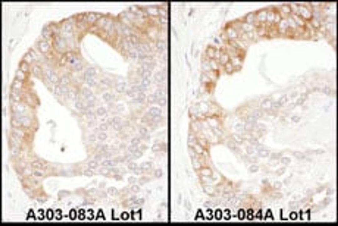 Detection of human EBP1 by immunohistochemistry.