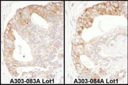 Detection of human EBP1 by immunohistochemistry.