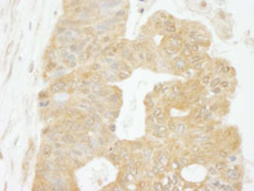 Detection of human eIF4G1 by immunohistochemistry.