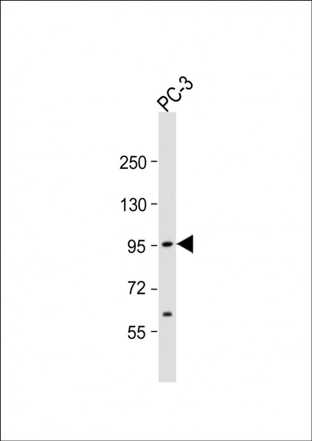 Western Blot at 1:1000 dilution + PC-3 whole cell lysate Lysates/proteins at 20 ug per lane.