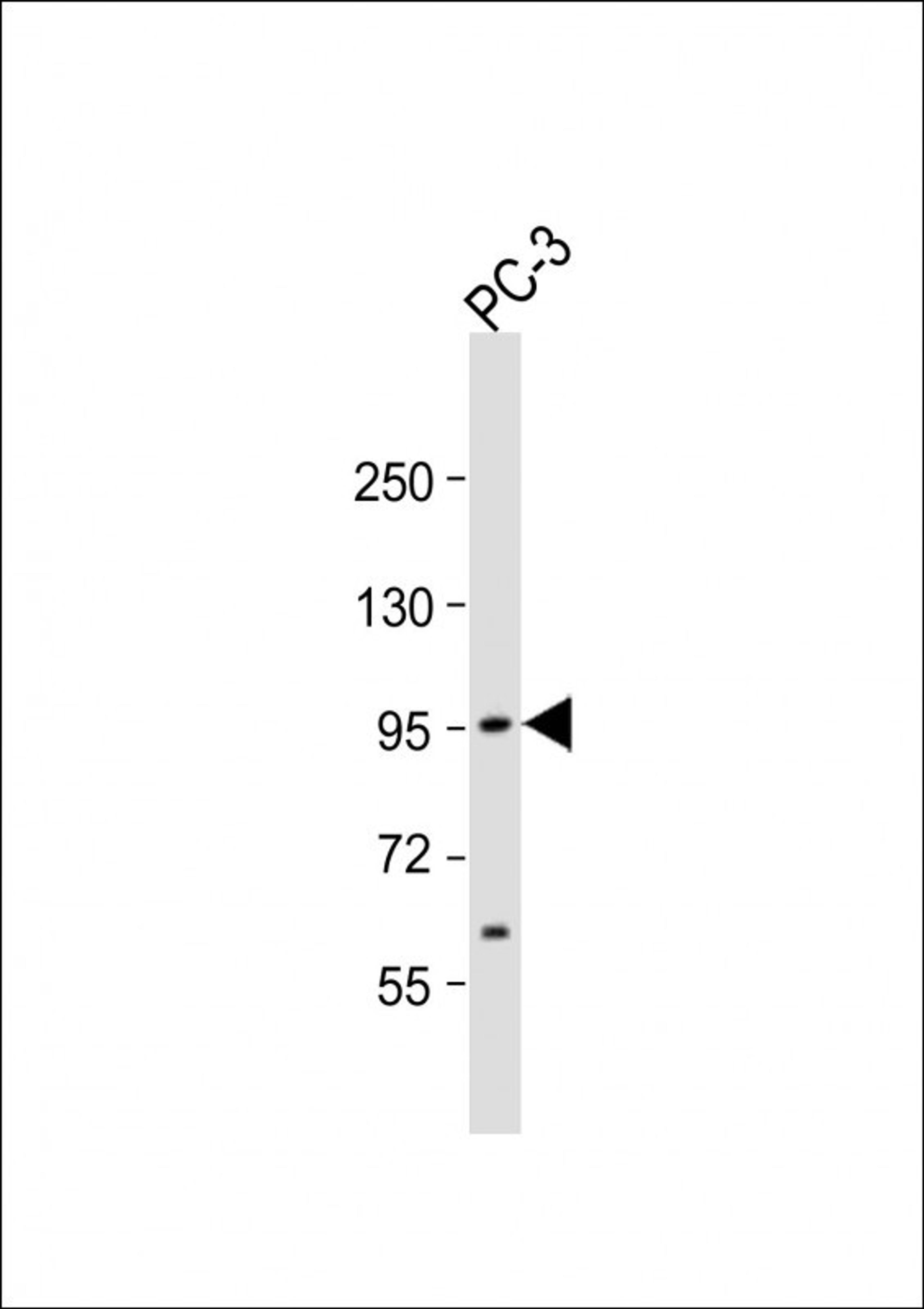 Western Blot at 1:1000 dilution + PC-3 whole cell lysate Lysates/proteins at 20 ug per lane.