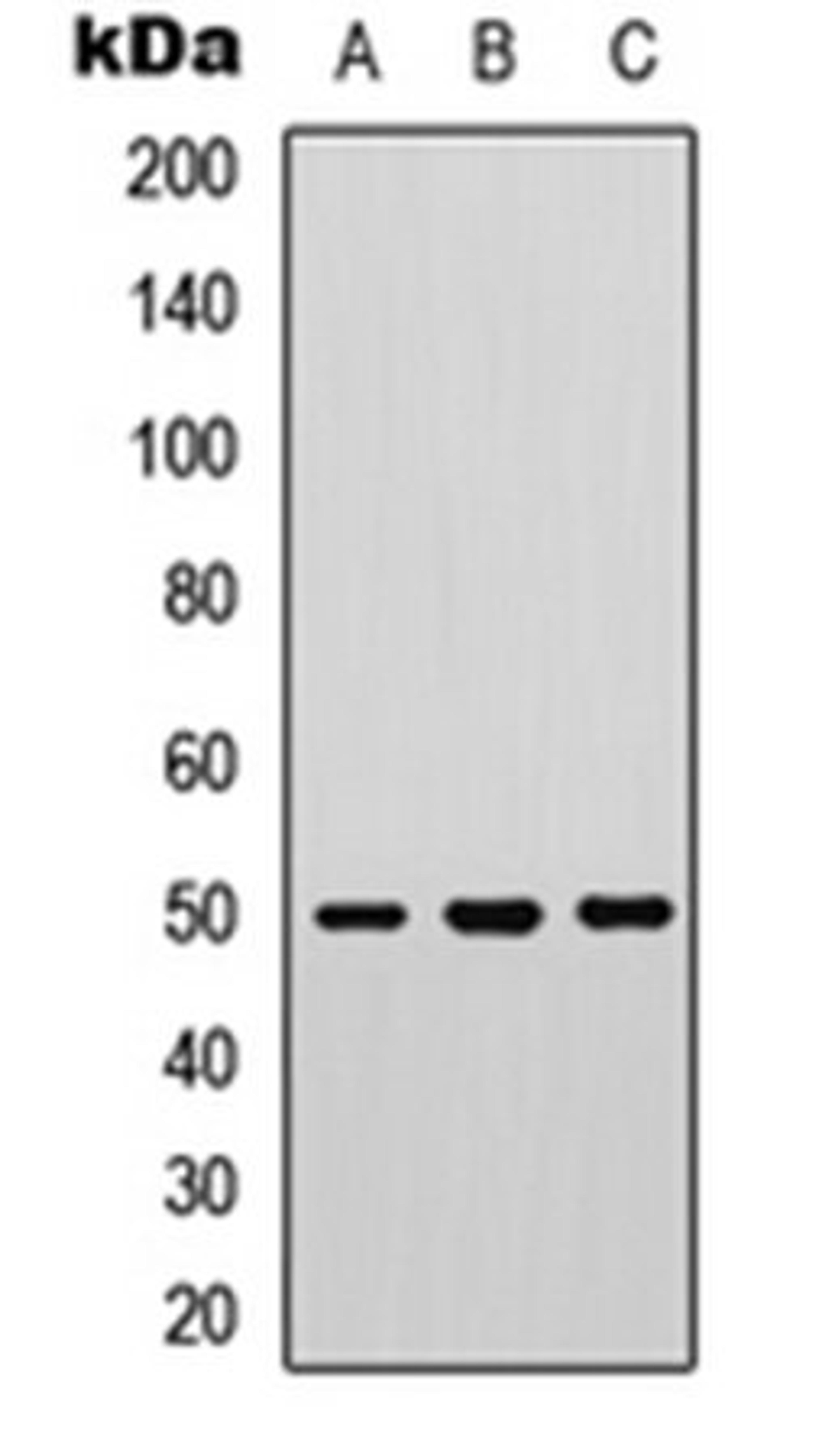 Western blot analysis of COLO205 (Lane 1), human muscle (Lane 2), mouse heart (Lane 3) whole cell lysates using PTP1B (phospho-S50) antibody