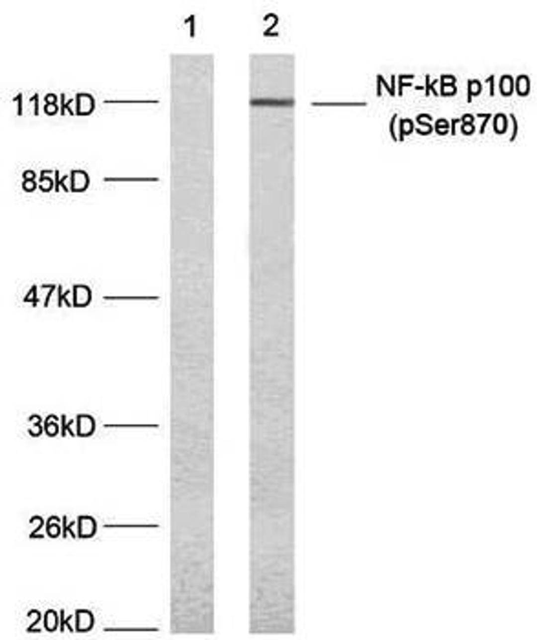 Western blot analysis of extract from MDA-MB-435 cells using NFkB-p100/p52(Phospho-Ser870) antibody