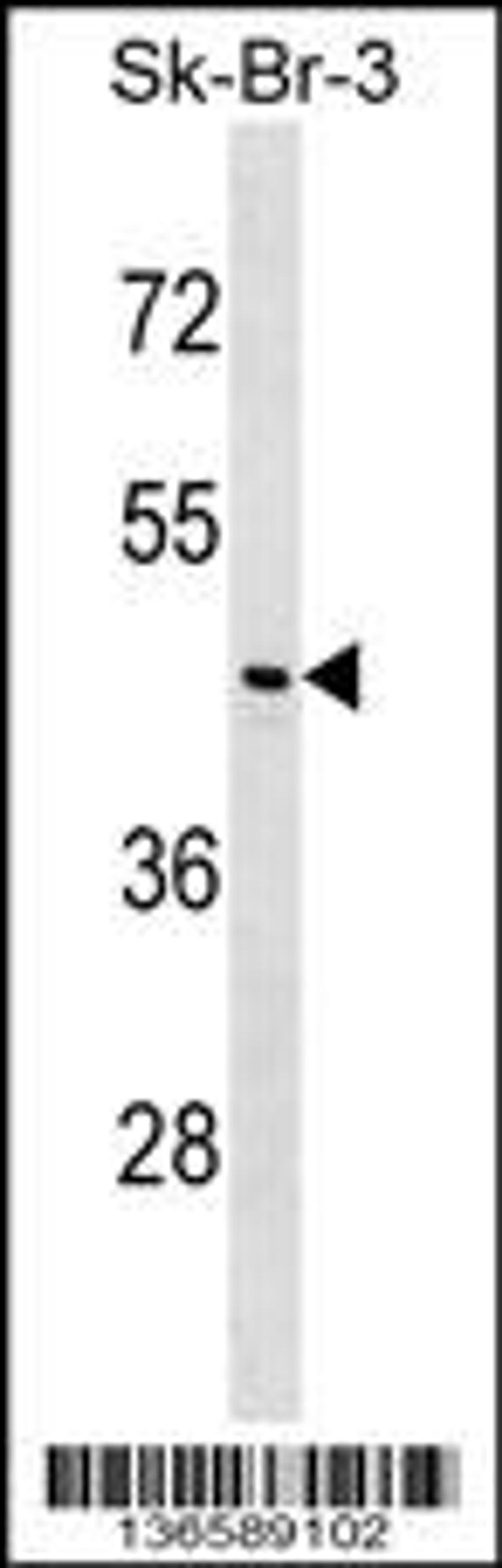 Western blot analysis in SK-BR-3 cell line lysates (35ug/lane).