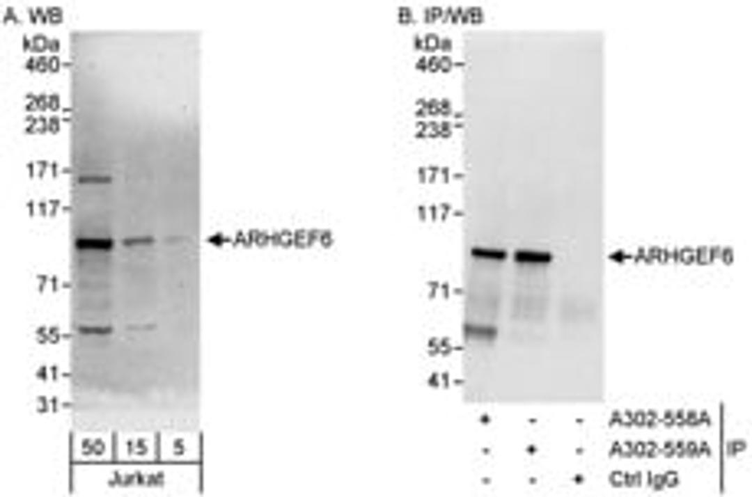 Detection of human ARHGEF6 by western blot and immunoprecipitation.