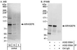 Detection of human ARHGEF6 by western blot and immunoprecipitation.