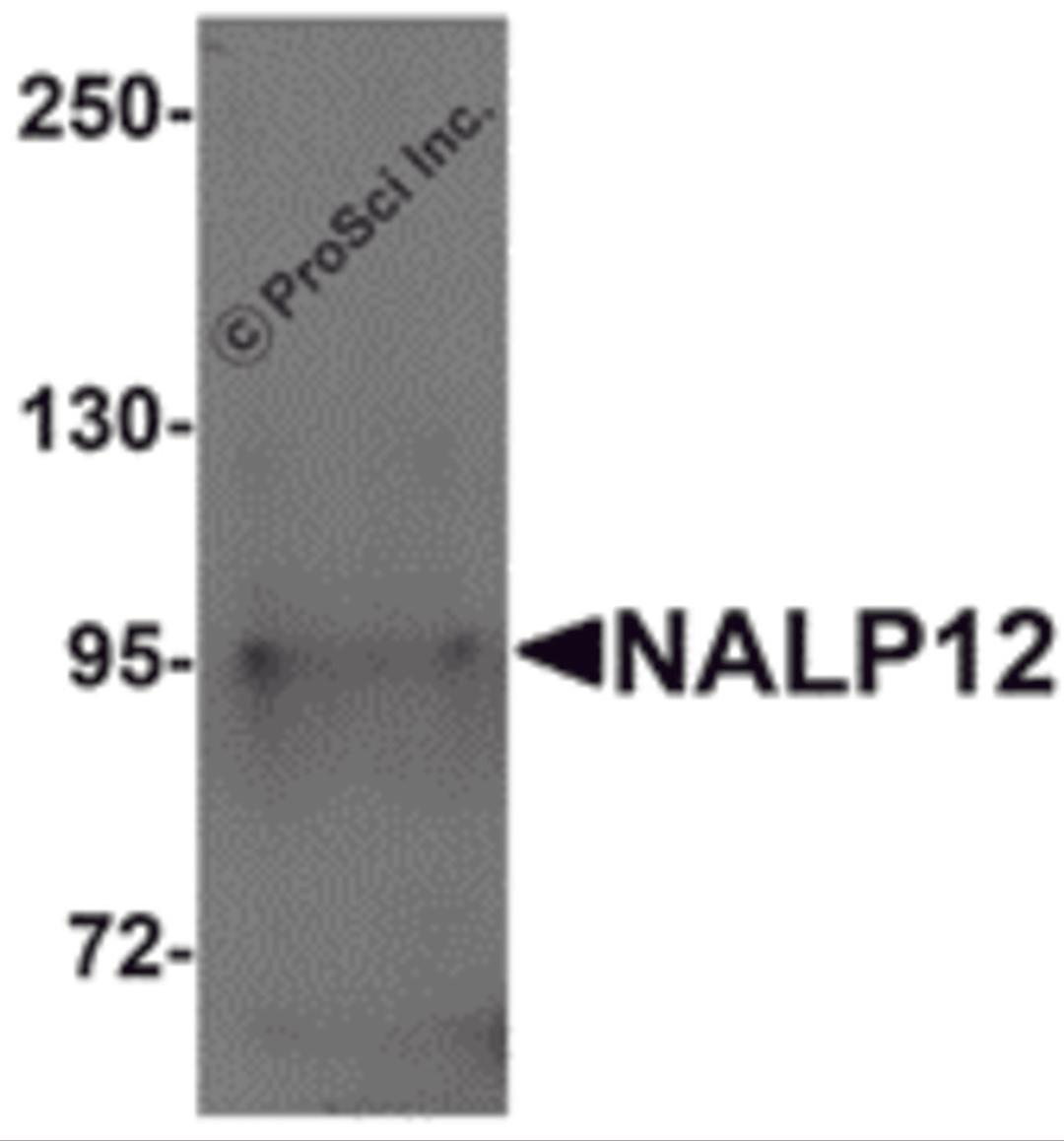 Western blot analysis of NALP12 in human brain tissue lysate with NALP12 antibody at 1 μg/mL.