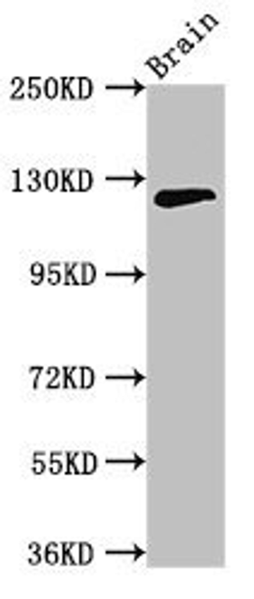 Western blot analysis of Mouse brain tissue using MYRF antibody