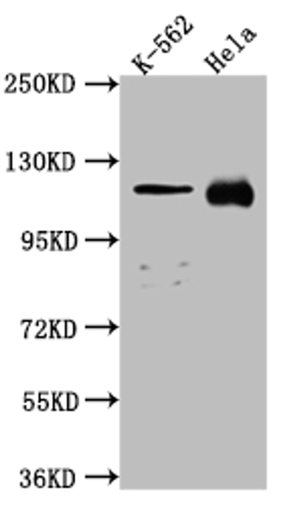 Western Blot. Positive WB detected in: K562 whole cell lysate, Hela whole cell lysate. All lanes: NUP98 antibody at 1:1000. Secondary. Goat polyclonal to rabbit IgG at 1/50000 dilution. Predicted band size: 198, 188, 98, 97, 196, 187 kDa. Observed band size: 100 kDa.