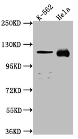 Western Blot. Positive WB detected in: K562 whole cell lysate, Hela whole cell lysate. All lanes: NUP98 antibody at 1:1000. Secondary. Goat polyclonal to rabbit IgG at 1/50000 dilution. Predicted band size: 198, 188, 98, 97, 196, 187 kDa. Observed band size: 100 kDa.