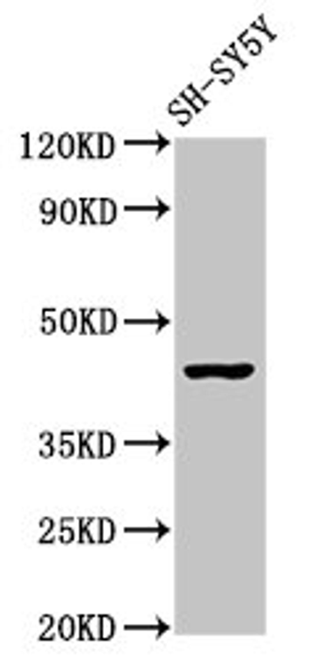 Western Blot. Positive WB detected in: SH-SY5Y whole cell lysate. All lanes: OPRM1 antibody at 2.9µg/ml. Secondary. Goat polyclonal to rabbit IgG at 1/50000 dilution. Predicted band size: 45, 44, 50, 48, 46, 56, 35, 37, 34, 14, 11, 21 kDa. Observed band size: 45 kDa