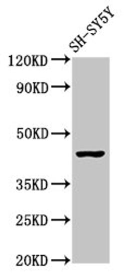 Western Blot. Positive WB detected in: SH-SY5Y whole cell lysate. All lanes: OPRM1 antibody at 2.9µg/ml. Secondary. Goat polyclonal to rabbit IgG at 1/50000 dilution. Predicted band size: 45, 44, 50, 48, 46, 56, 35, 37, 34, 14, 11, 21 kDa. Observed band size: 45 kDa