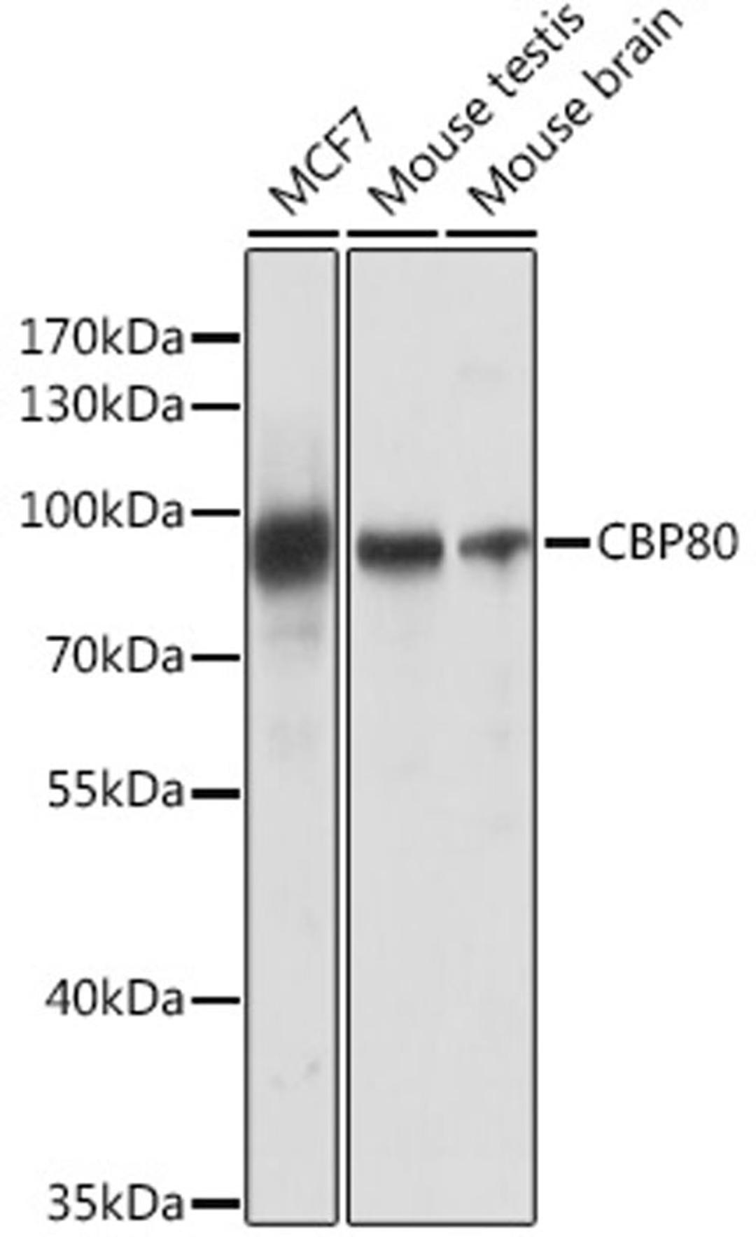 Western blot - CBP80 antibody (A13939)