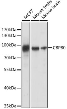 Western blot - CBP80 antibody (A13939)