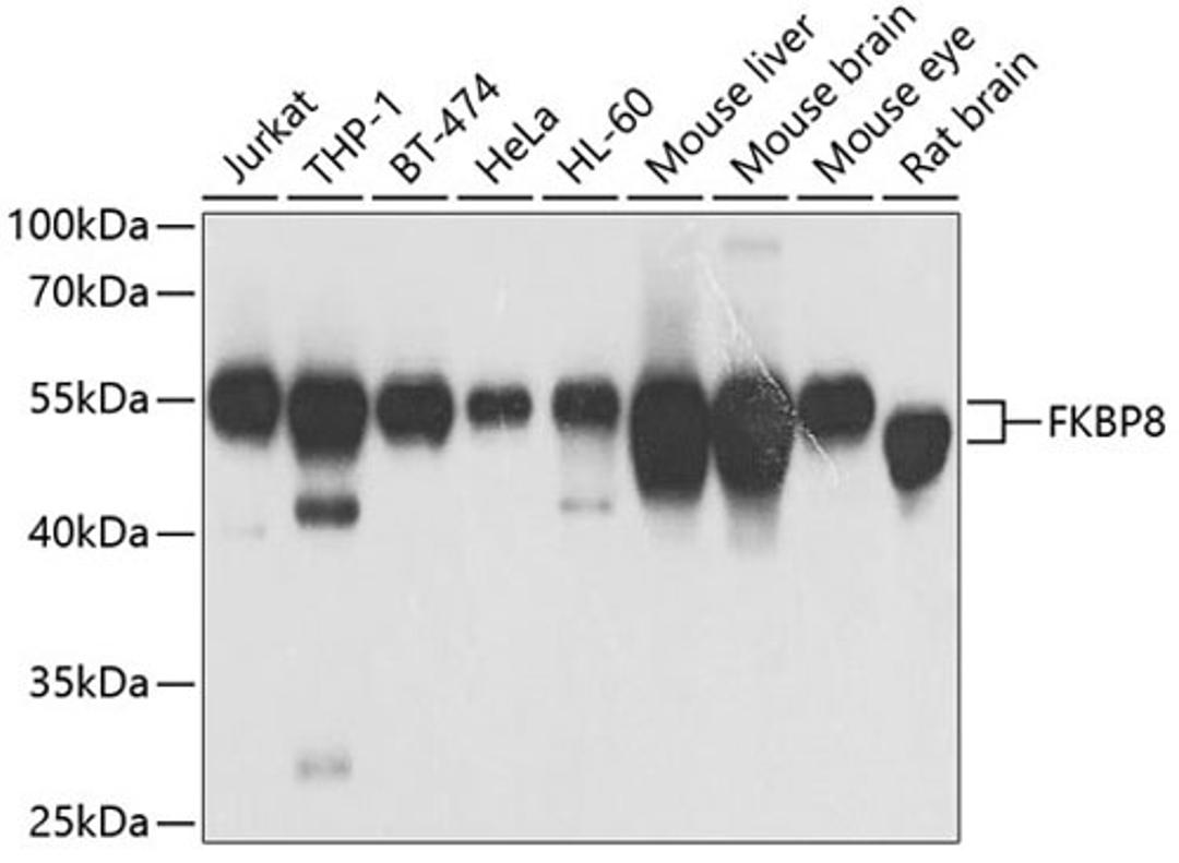 Western blot - FKBP8 antibody (A7085)