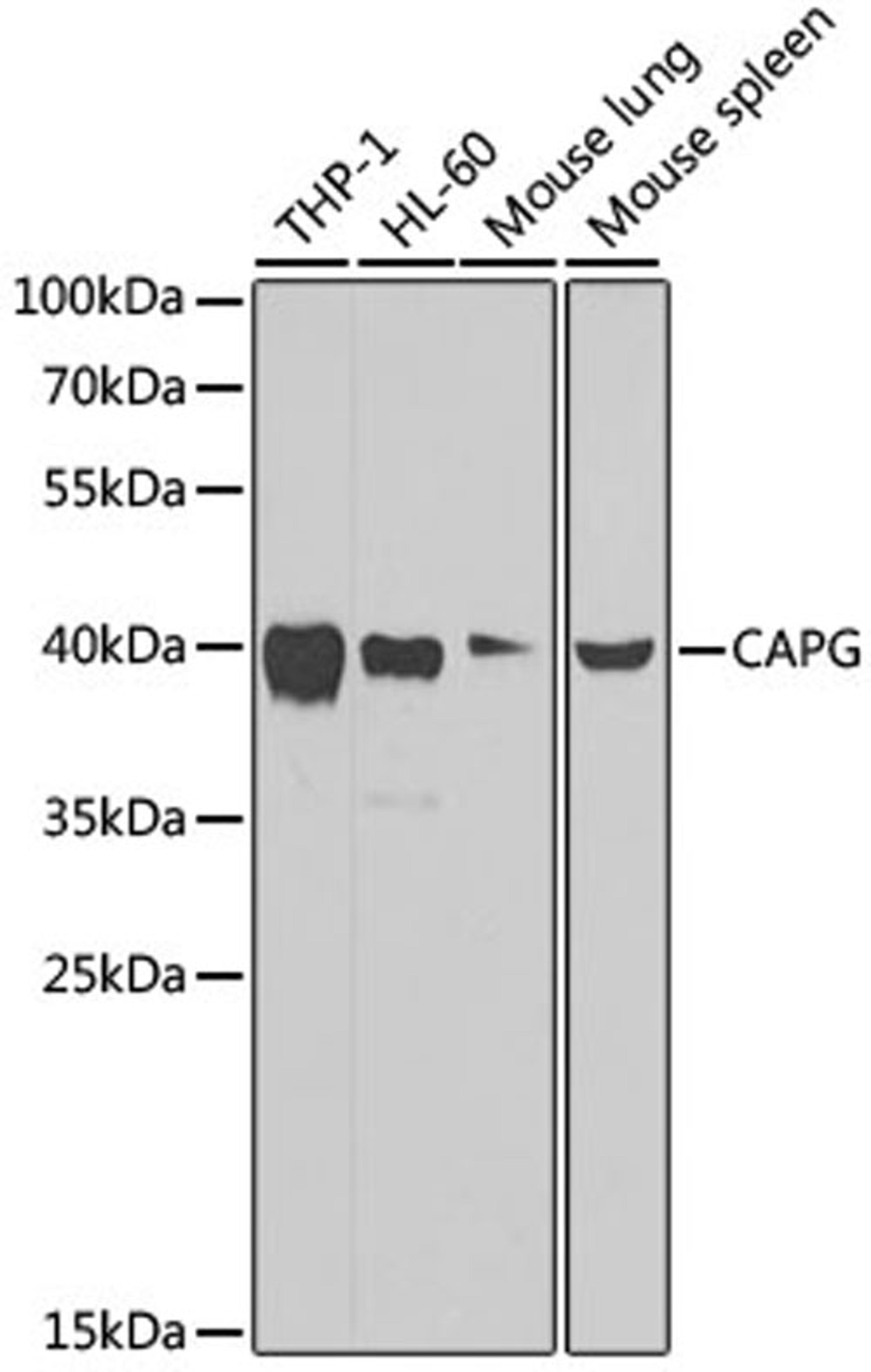 Western blot - CAPG Antibody (A7324)