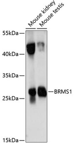 Western blot - BRMS1 antibody (A14865)