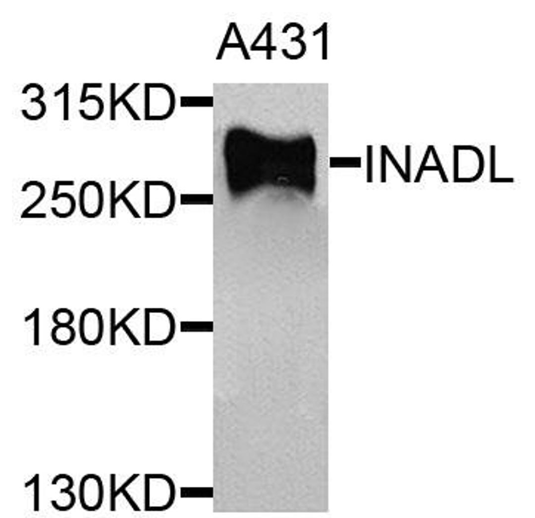 Western blot analysis of extracts of A431 cells using INADL antibody