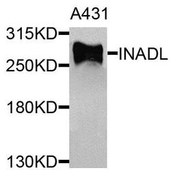 Western blot analysis of extracts of A431 cells using INADL antibody