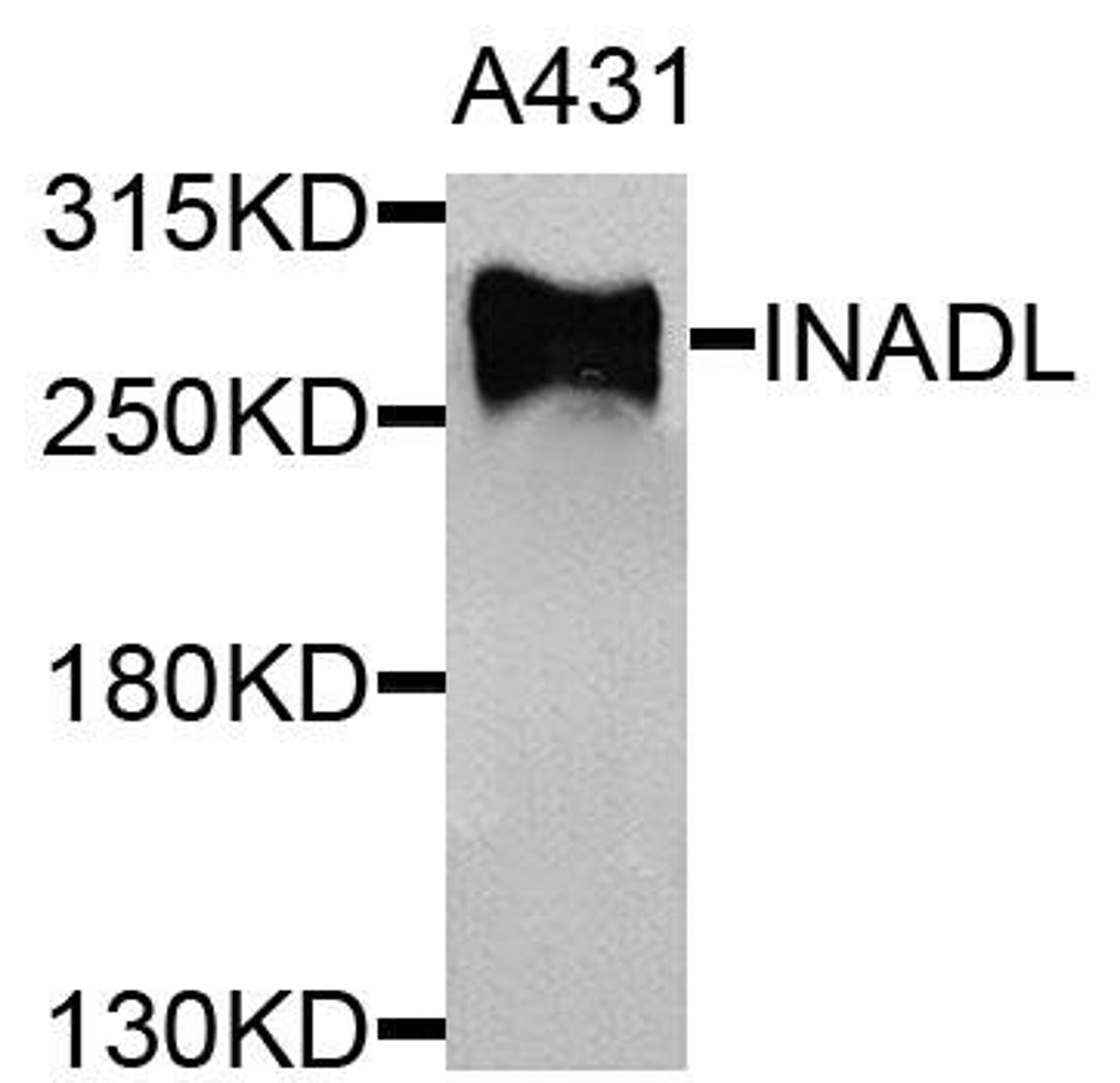 Western blot analysis of extracts of A431 cells using INADL antibody