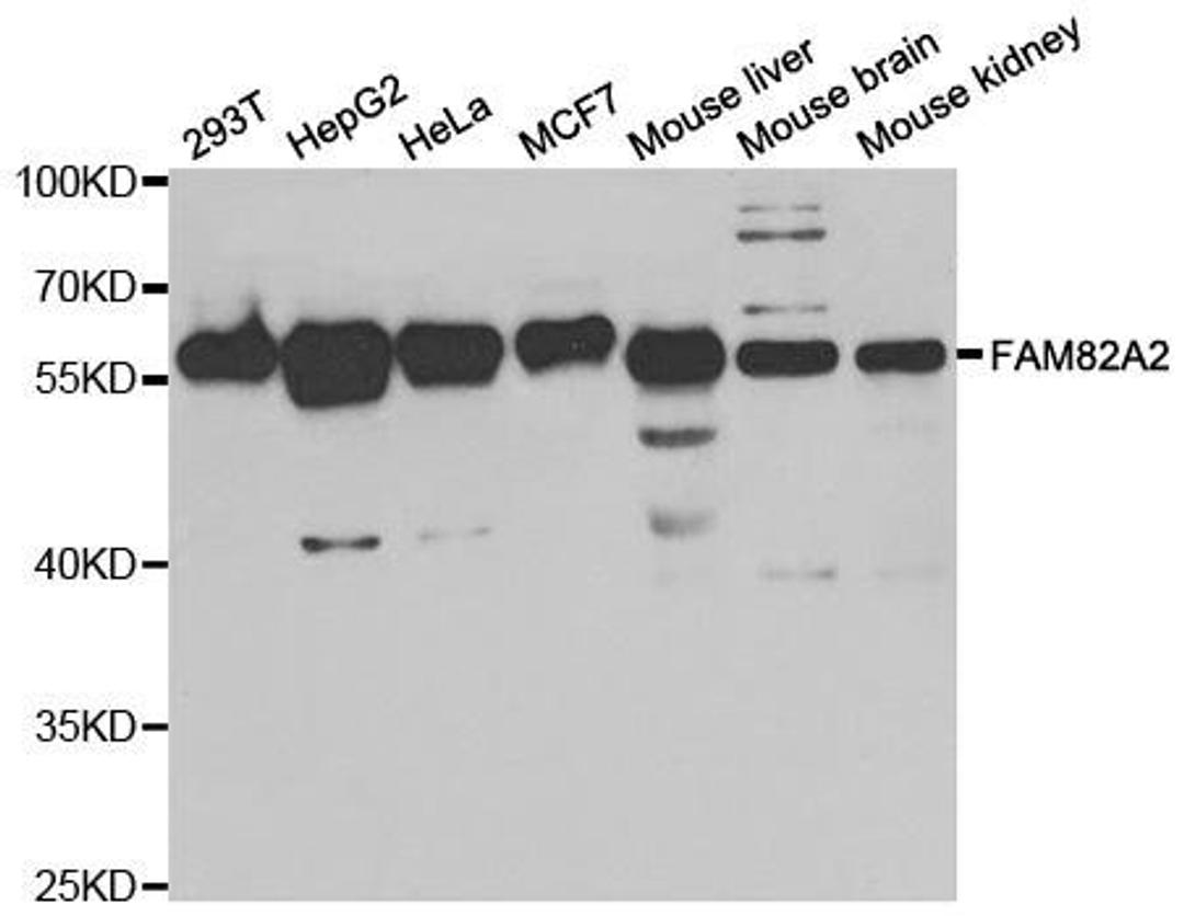 Western blot analysis of extracts of various cell lines using FAM82A2 antibody