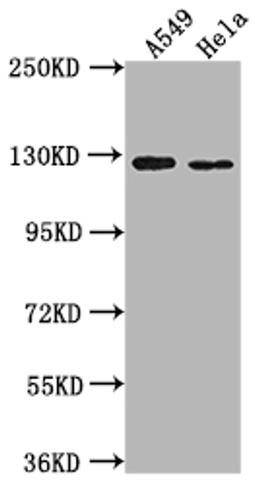 Western Blot. Positive WB detected in: A549 whole cell lysate, Hela whole cell lysate. All lanes: IGSF3 antibody at 1:2000. Secondary. Goat polyclonal to rabbit IgG at 1/50000 dilution. Predicted band size: 136, 138 kDa. Observed band size: 125 kDa.
