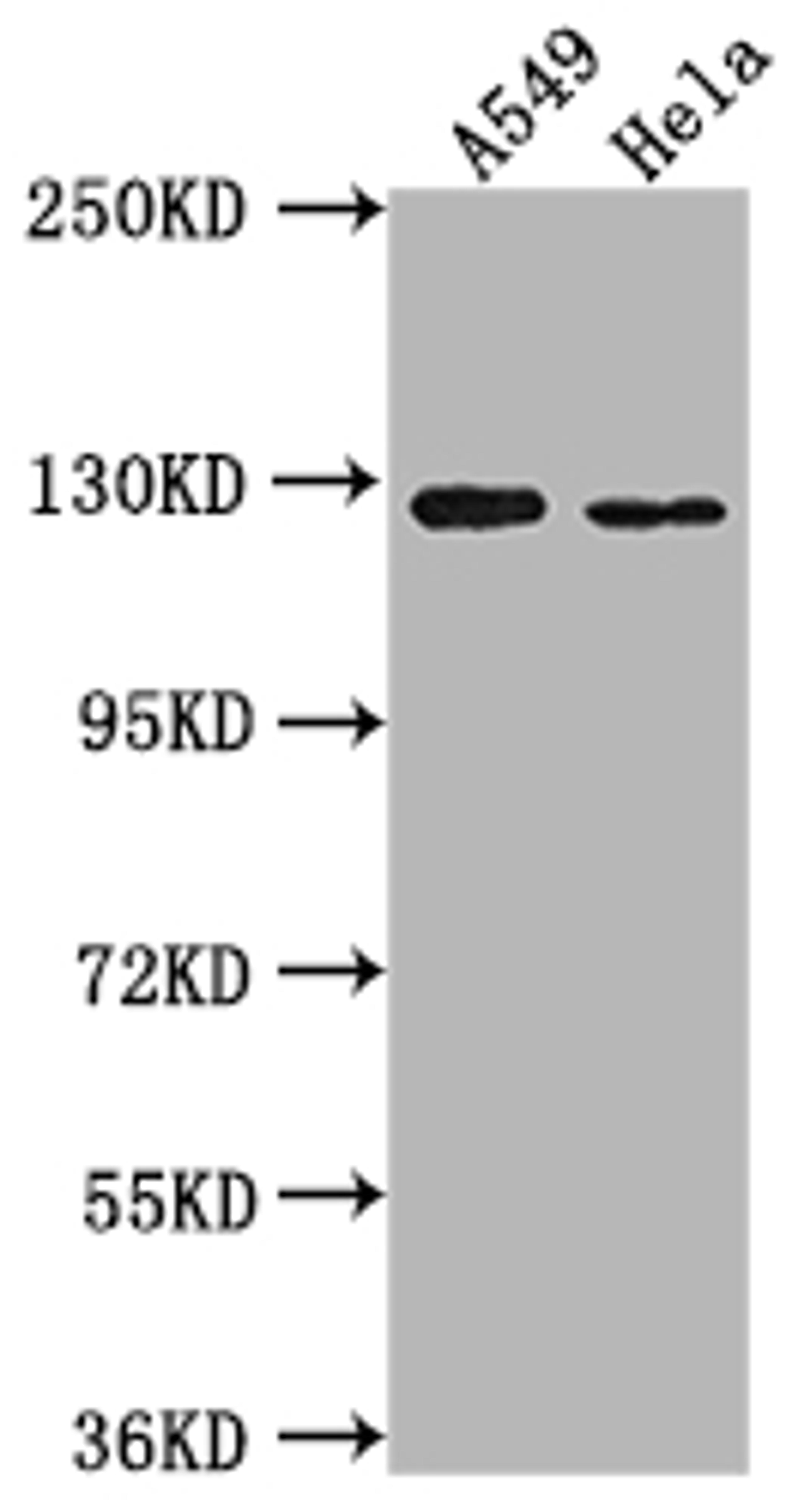 Western Blot. Positive WB detected in: A549 whole cell lysate, Hela whole cell lysate. All lanes: IGSF3 antibody at 1:2000. Secondary. Goat polyclonal to rabbit IgG at 1/50000 dilution. Predicted band size: 136, 138 kDa. Observed band size: 125 kDa.
