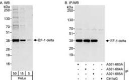 Detection of human EF-1 delta by western blot and immunoprecipitation.