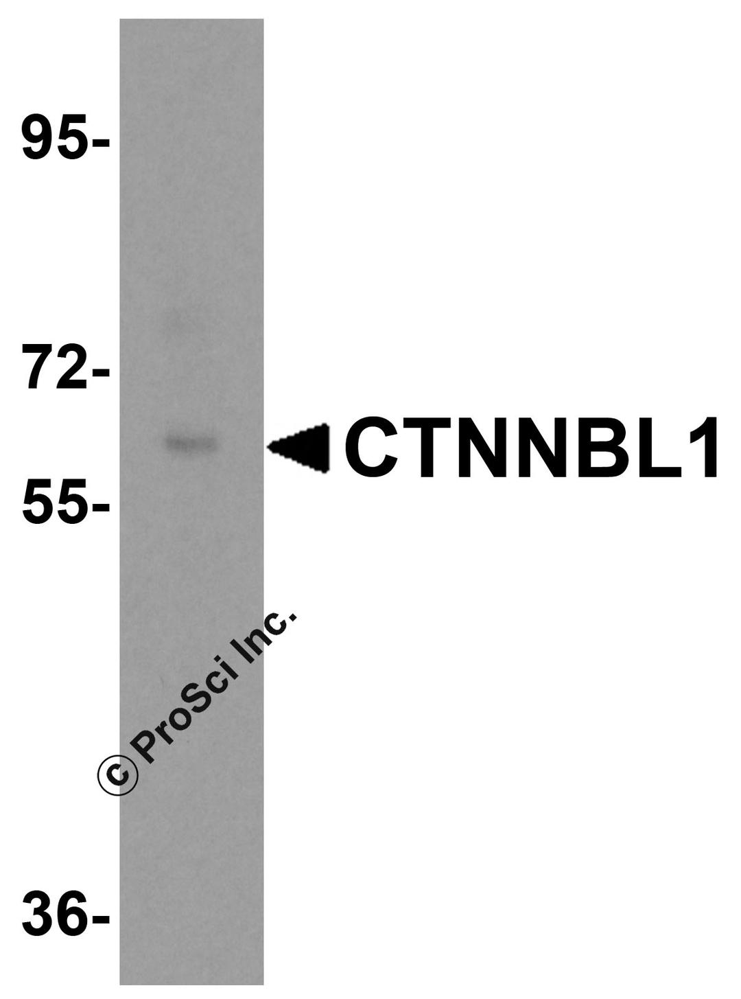 Western blot analysis of CTNNBL1 in human brain tissue lysate with CTNNBL1 antibody at 0.5 μg/mL.