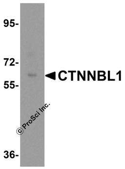 Western blot analysis of CTNNBL1 in human brain tissue lysate with CTNNBL1 antibody at 0.5 μg/mL.