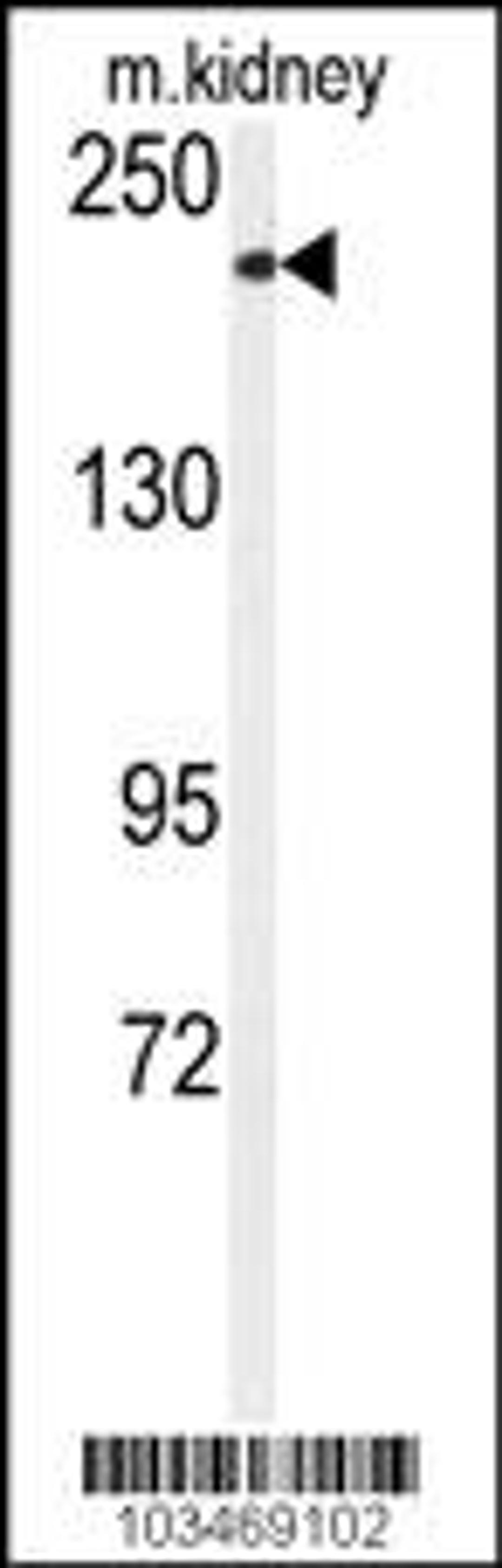 Western blot analysis of anti-CHAK1 Antibody in mouse kidney tissue lysates (35ug/lane)