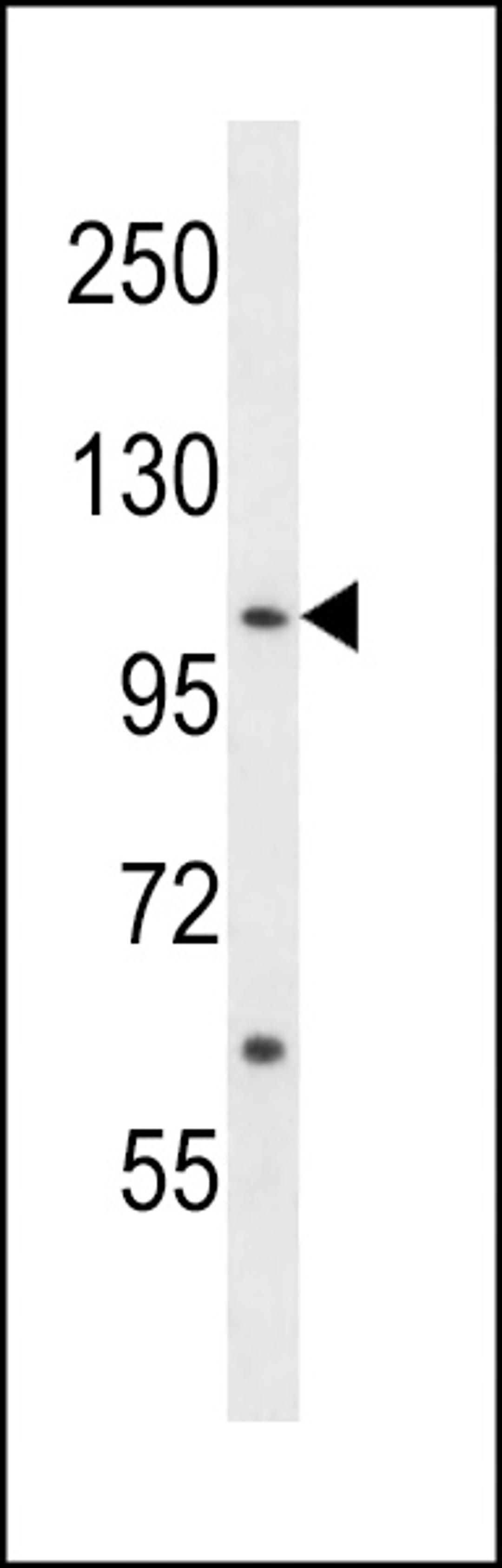 Western blot analysis in NCI-H460 cell line lysates (35ug/lane).This demonstrates the ACK1 antibody detected the ACK1 protein (arrow).