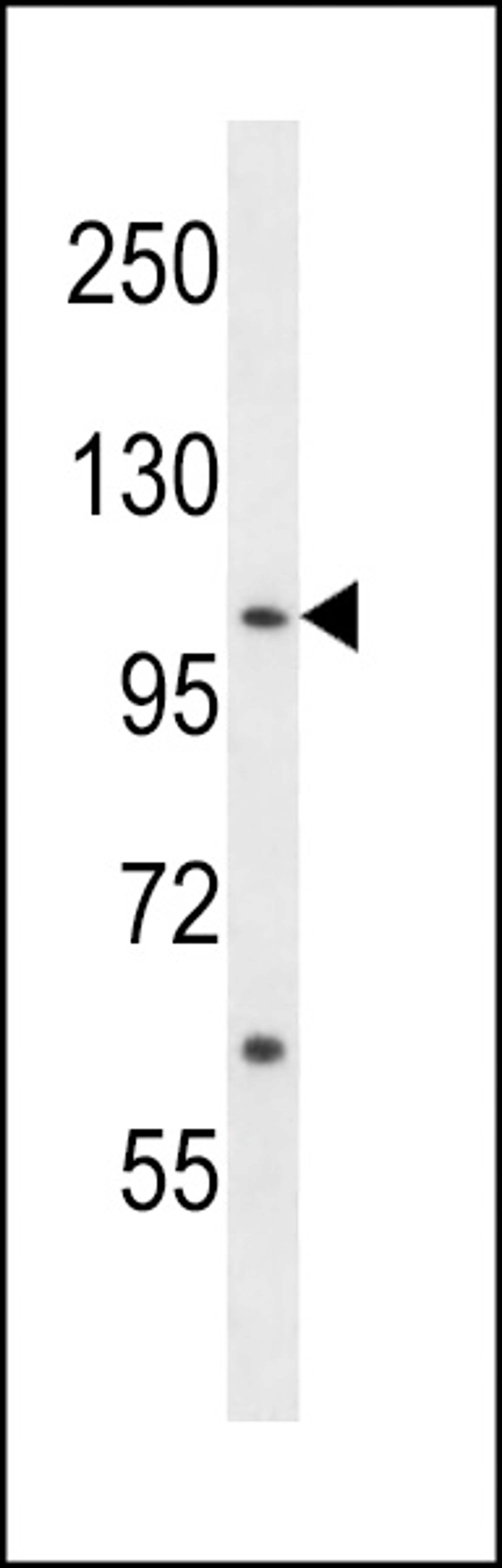 Western blot analysis in NCI-H460 cell line lysates (35ug/lane).This demonstrates the ACK1 antibody detected the ACK1 protein (arrow).