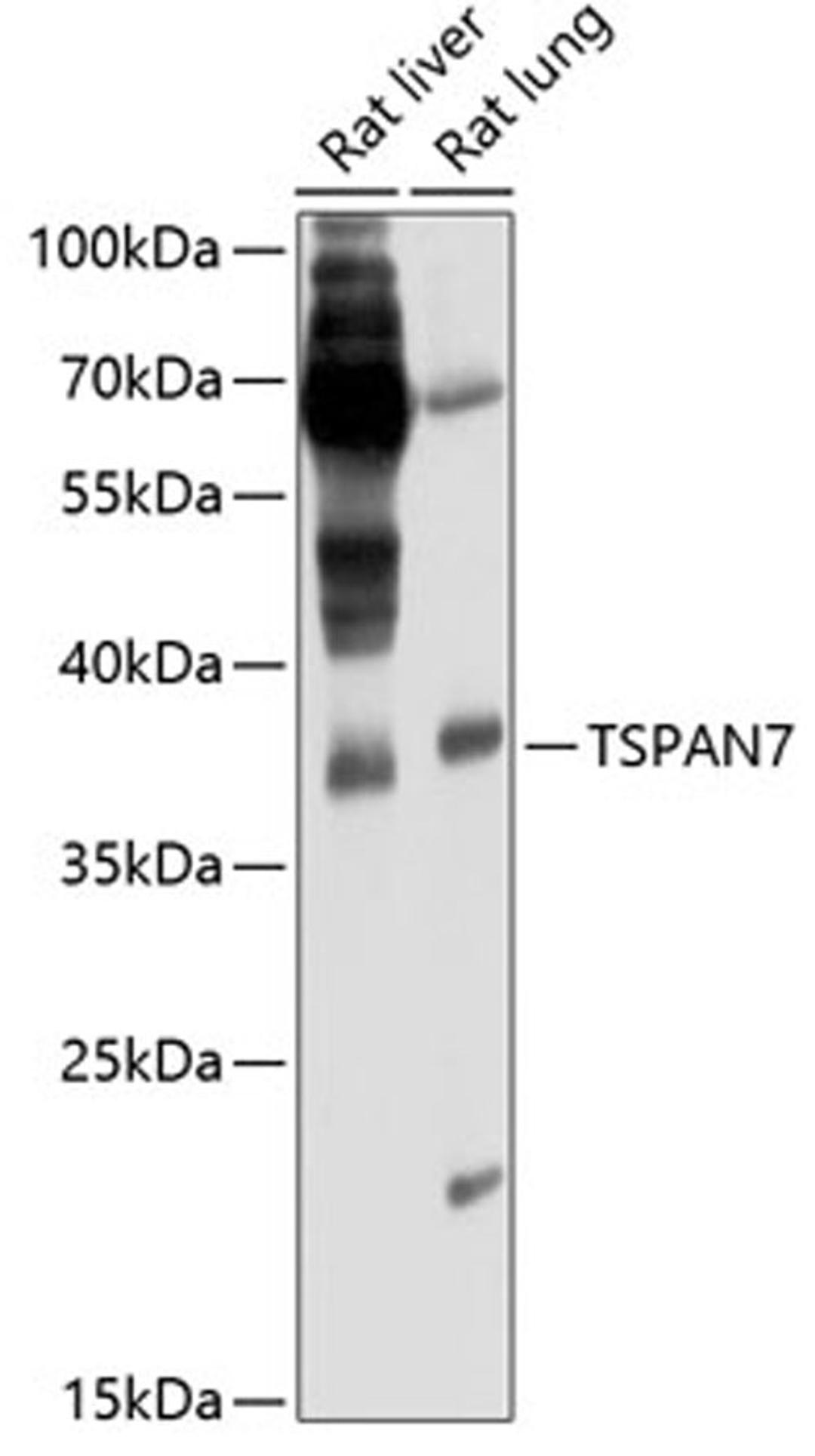 Western blot - TSPAN7 antibody (A6417)