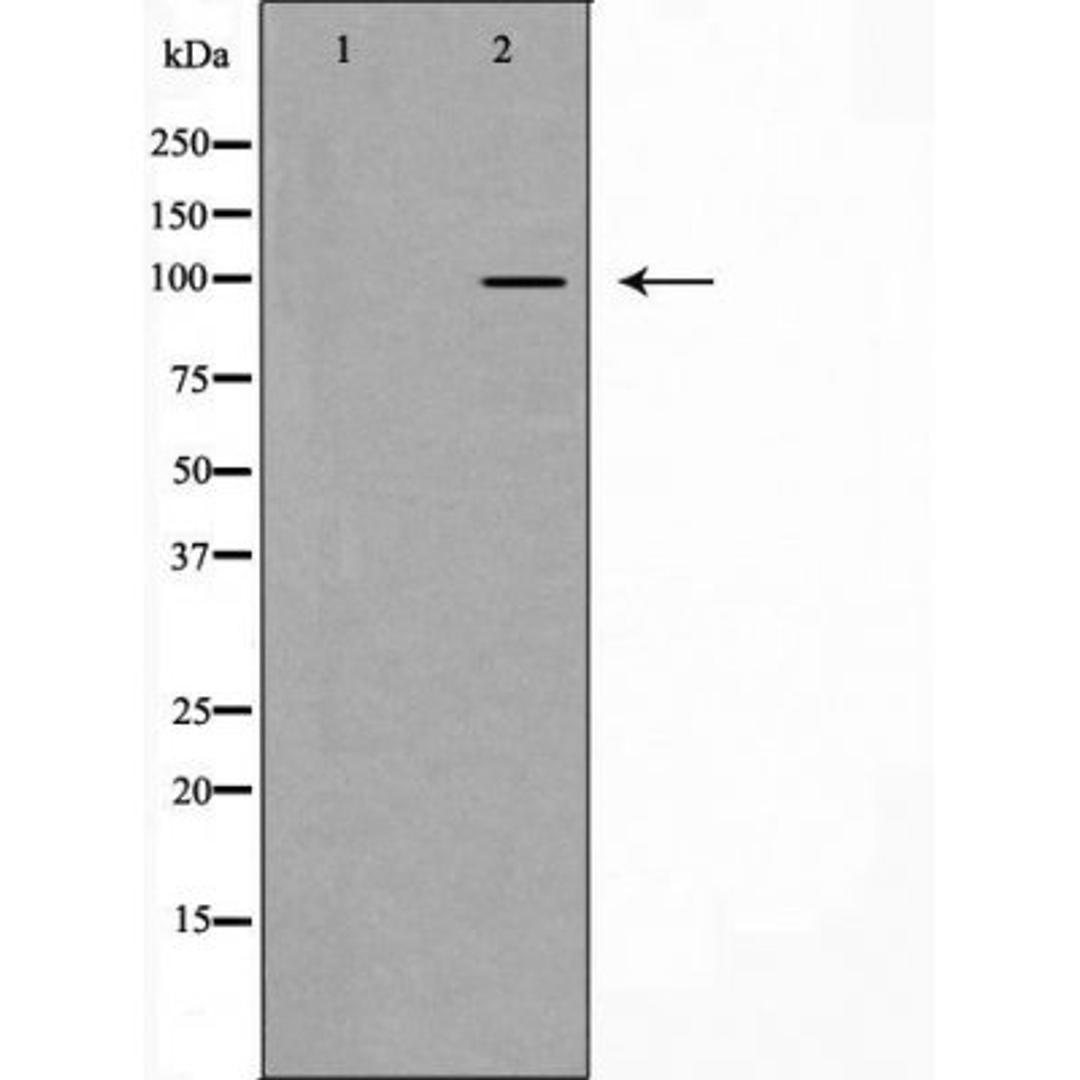 Western blot analysis of Hela cell lysate using Catenin Alpha1 antibody