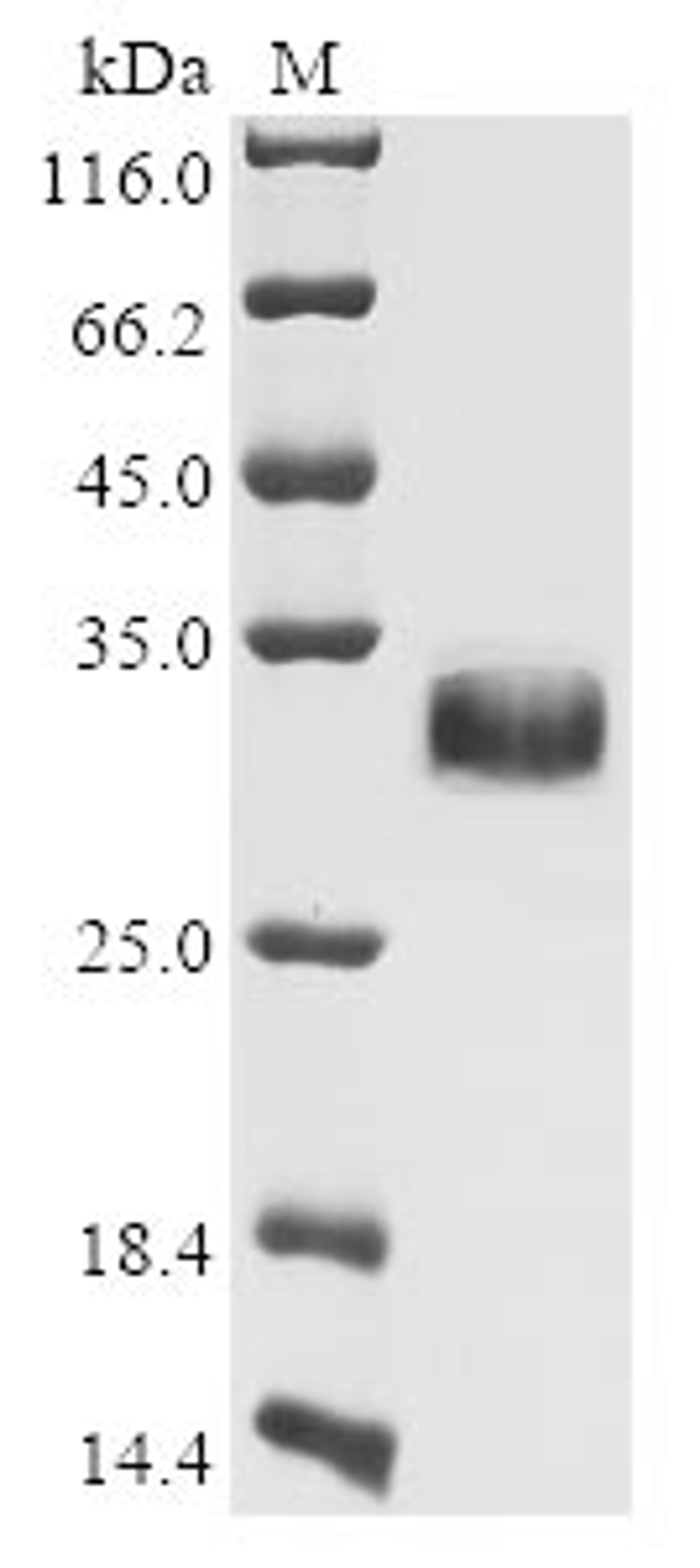 (Tris-Glycine gel) Discontinuous SDS-PAGE (reduced) with 5% enrichment gel and 15% separation gel.