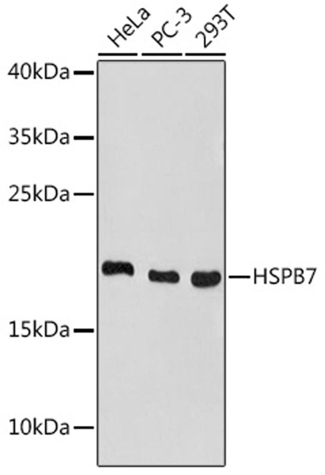 Western blot - HSPB7 antibody (A18450)